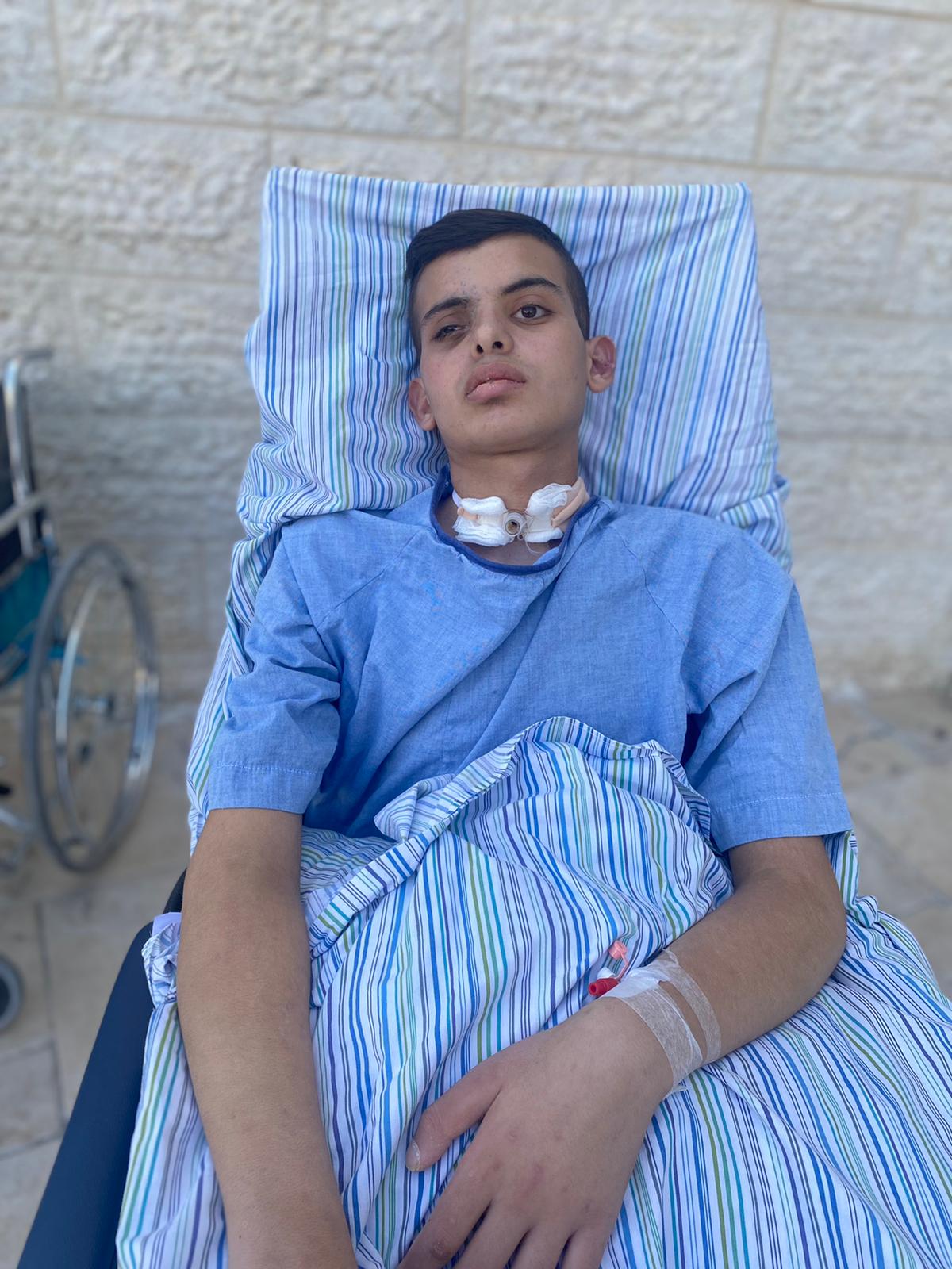 16-year-old Ashraf Mahmoud Najeeb Farahti remains in the intensive care unit after Israeli forces shot him in the right eye. (Photo: Courtesy of the Farahti family)